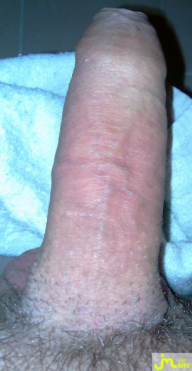 Photo de la bite de Markusgargo