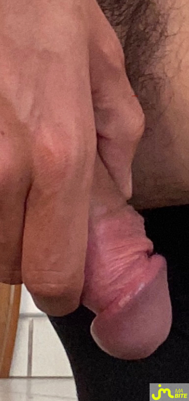 bites de Gotaaaa