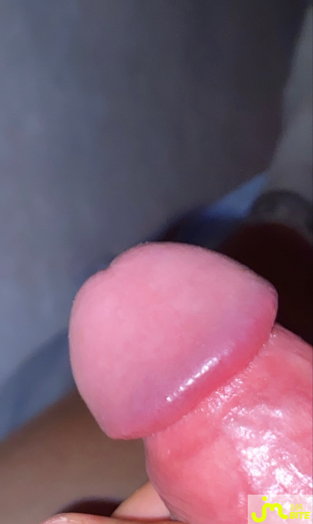 bites de Gotaaaa