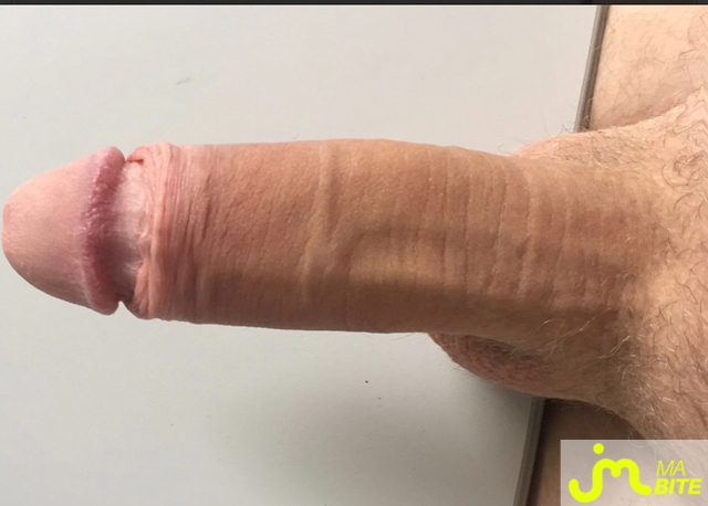bites de Fucknfurious