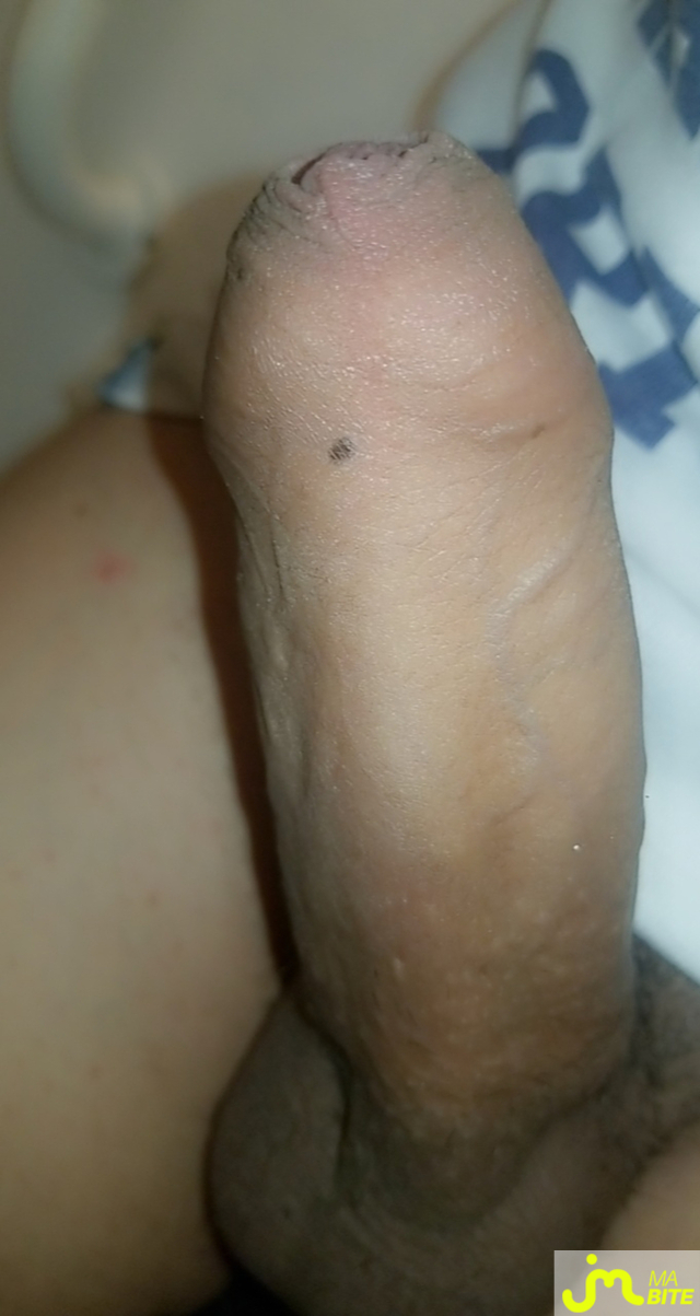 bites de Kevin de toulon