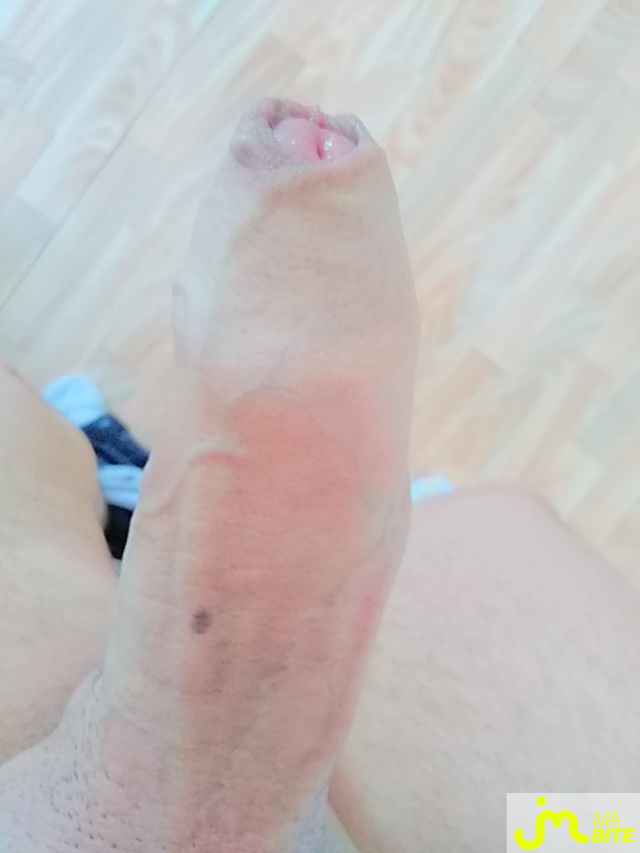 bites de Davidty56