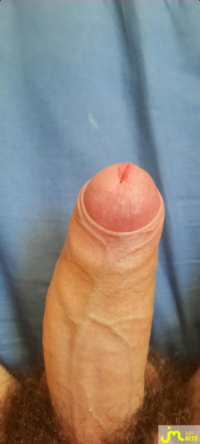bites de Mikessed