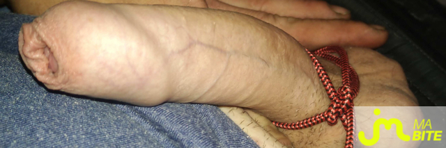 bites de PUCEAU_20CM