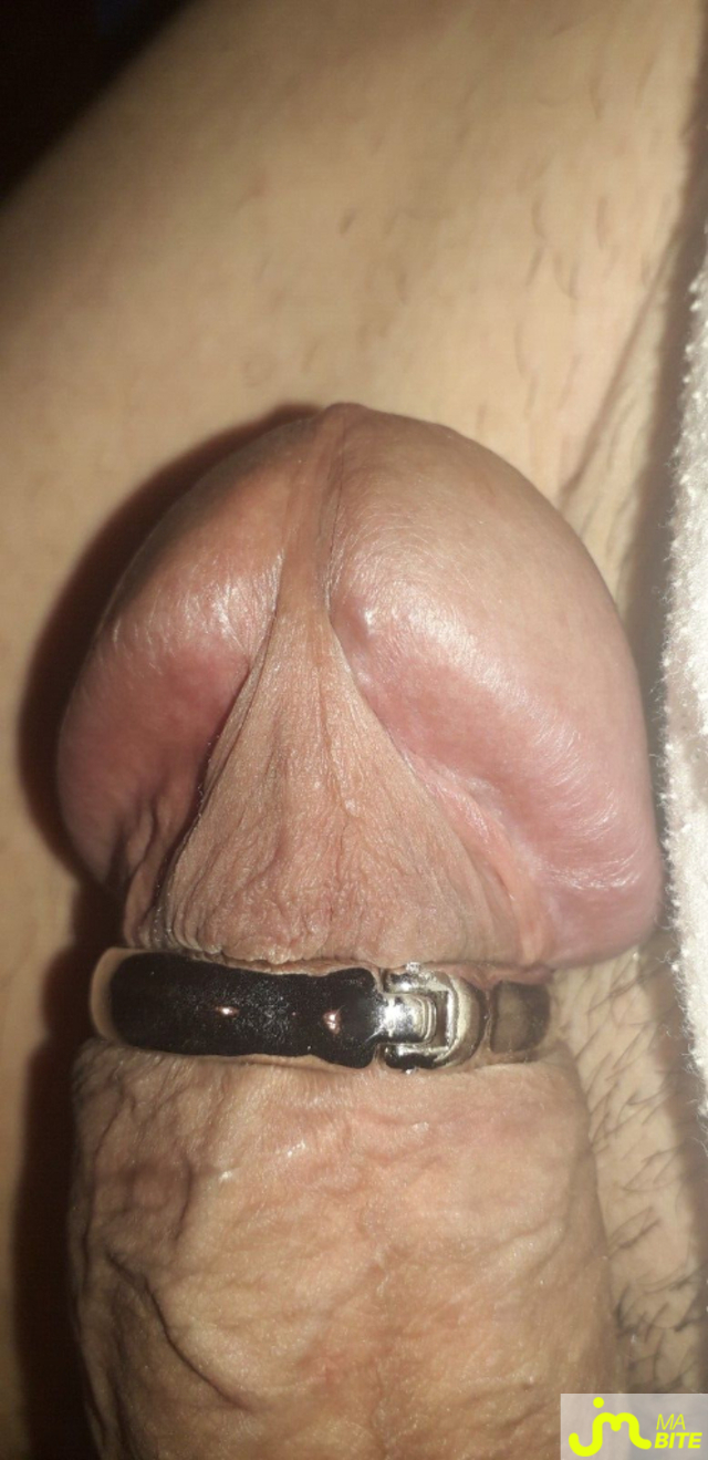 bites de scatochris