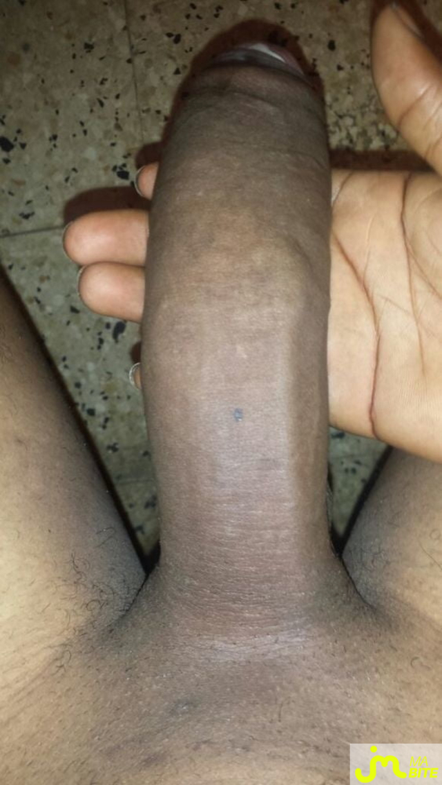 bites de Minigros