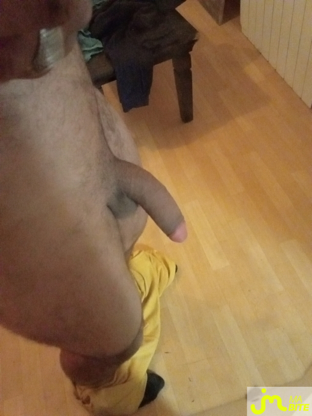 bites de Saico