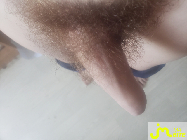 bites de Marcus34