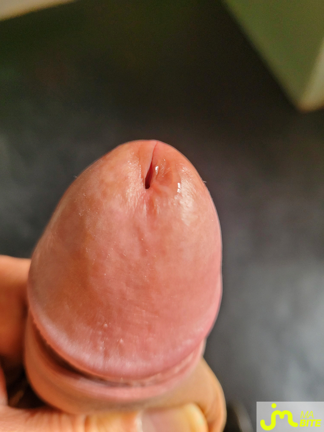 bites de TEBE