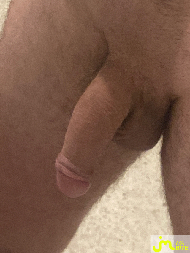 bites de YGM445622
