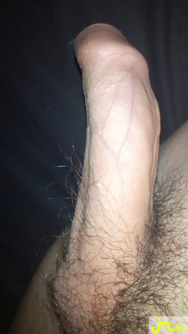 bites de Azerta