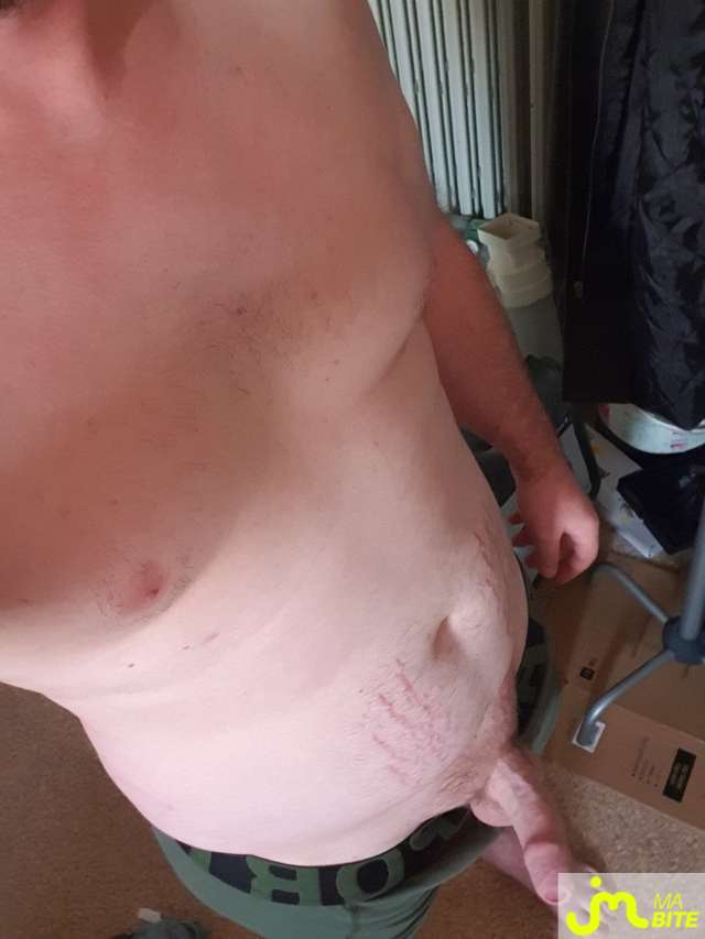 bites de alex__64