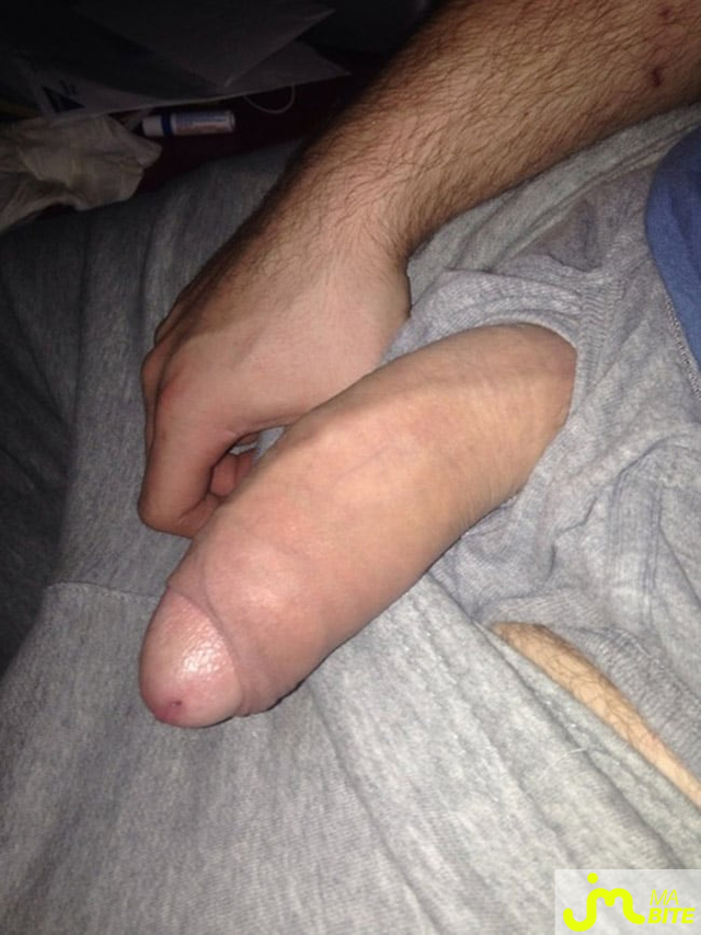 bites de Bigzilla