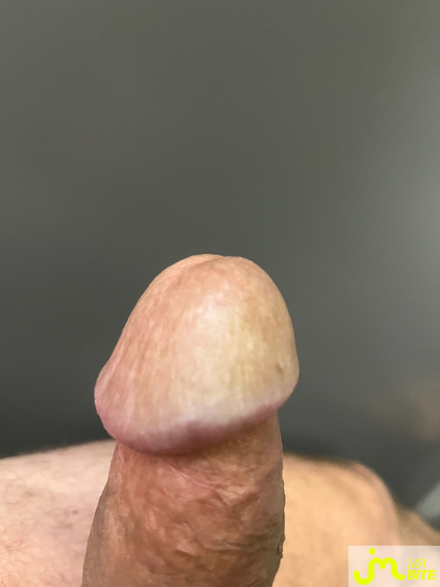 bites de Ret