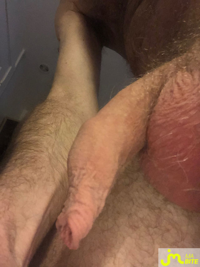 bites de longprepuce