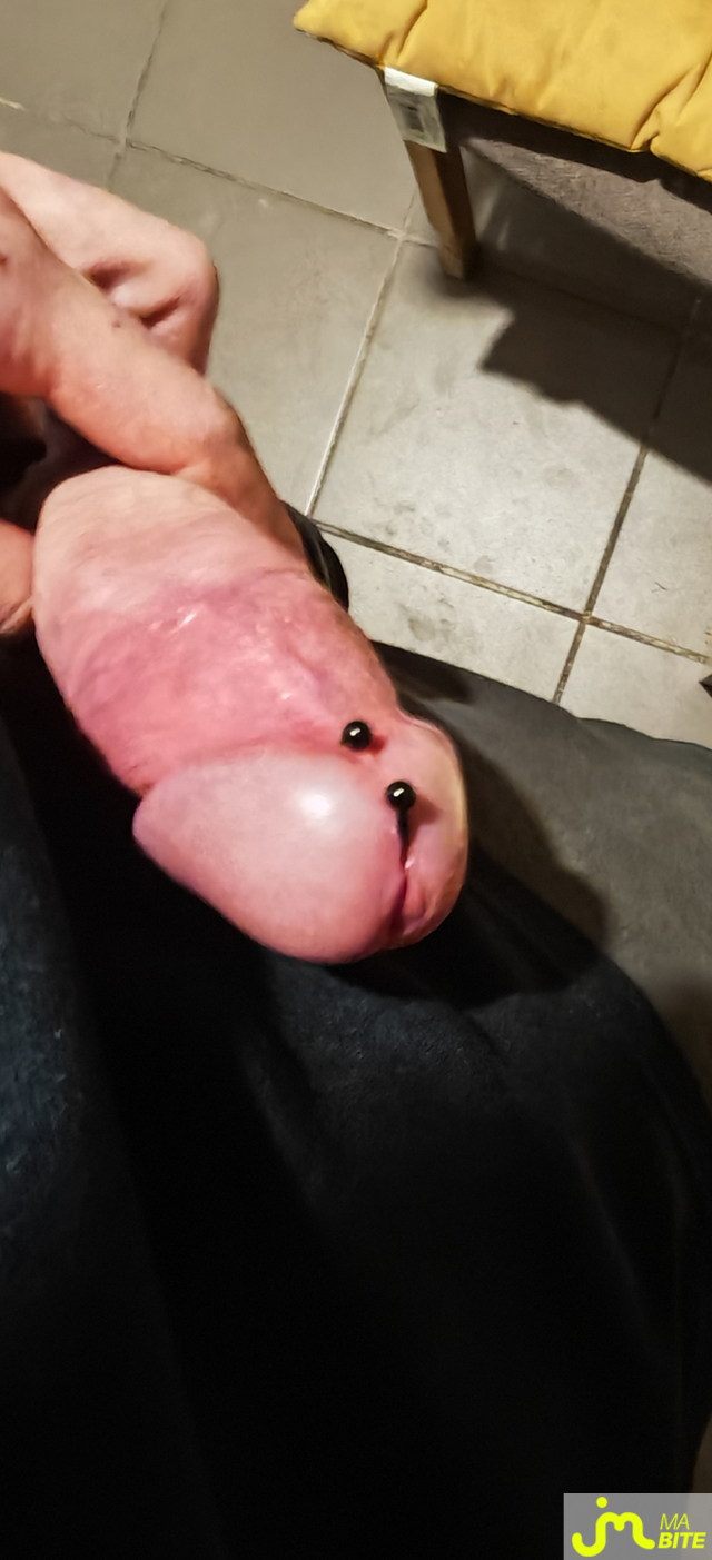 bites de Ludovicdu62520