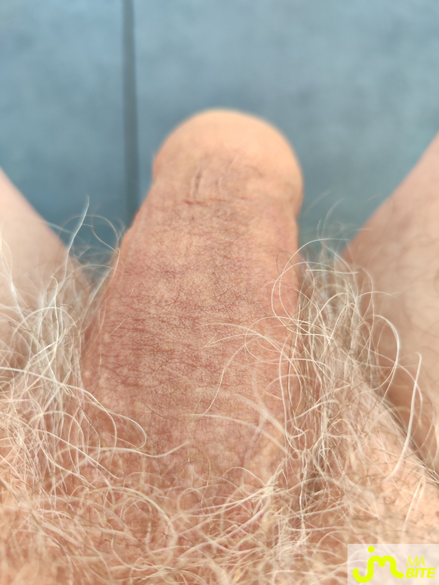 bites de minglet