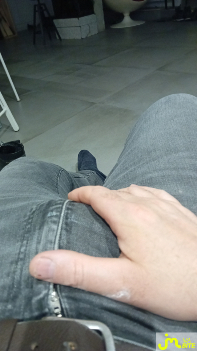 bites de De la llave
