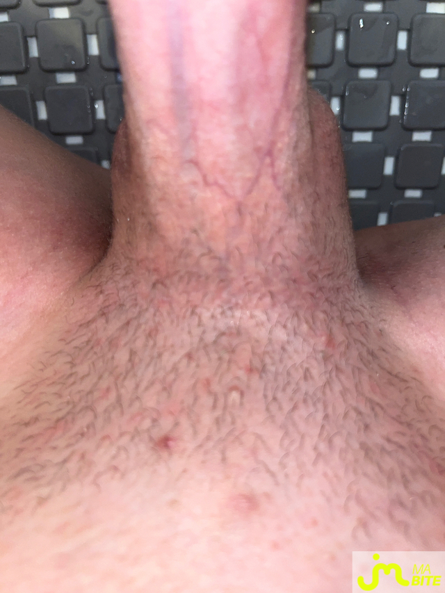 bites de Arturosdunord