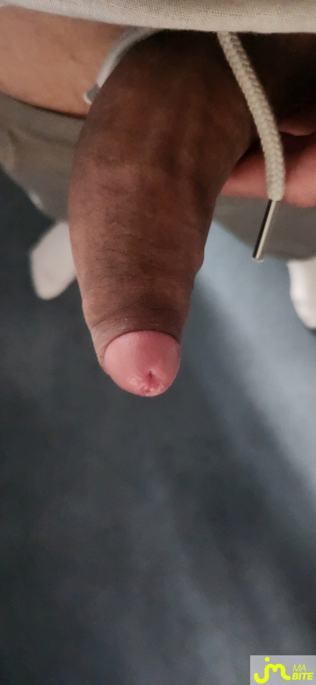 bites de koala1021