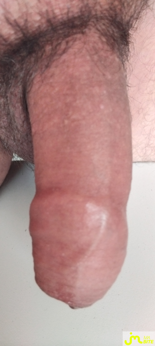 bites de Couple calins