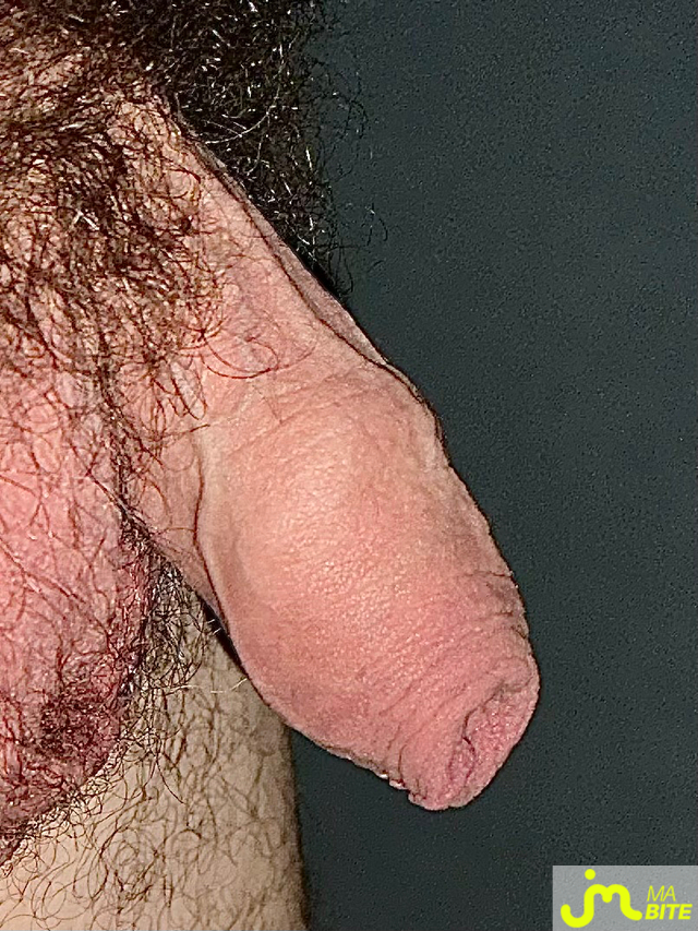 bites de Couplenature