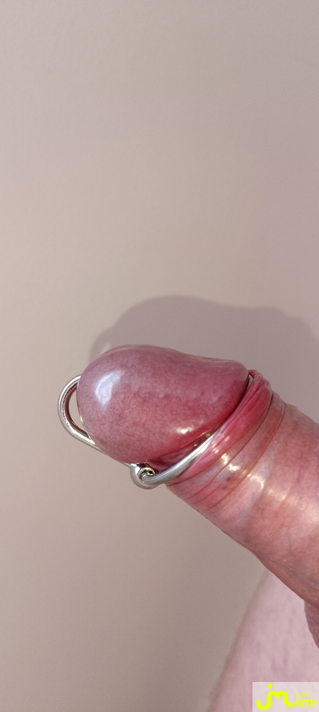 bites de Sexebuccal