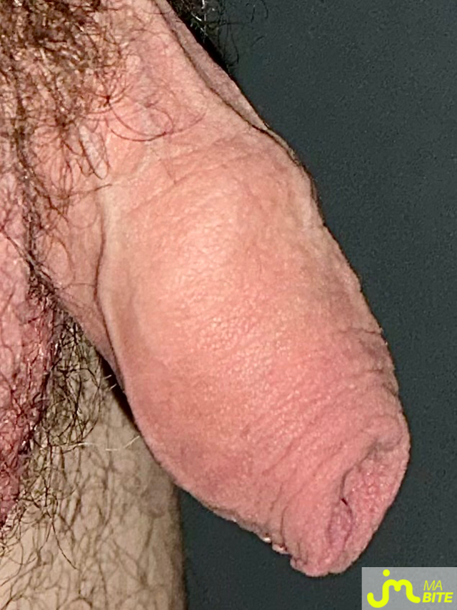 bites de Couplenature