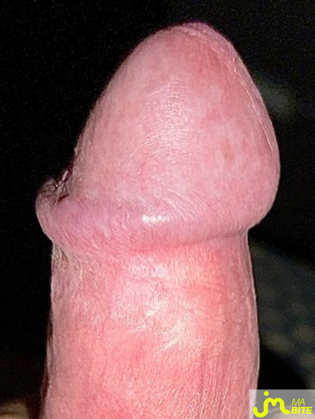 bites de Couplenature