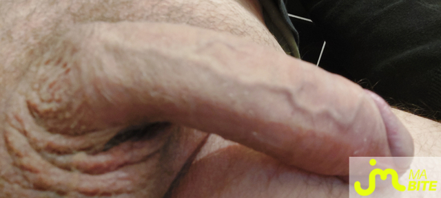 bites de Ced76