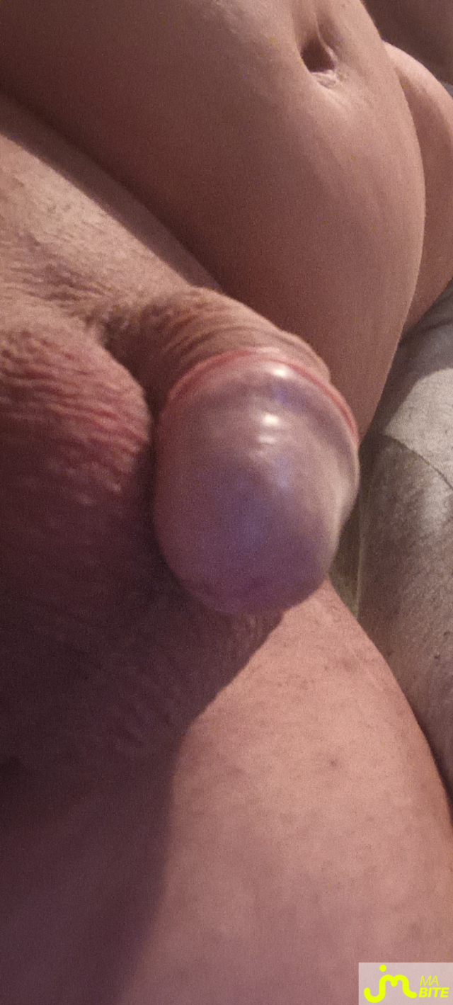 bites de gigi460