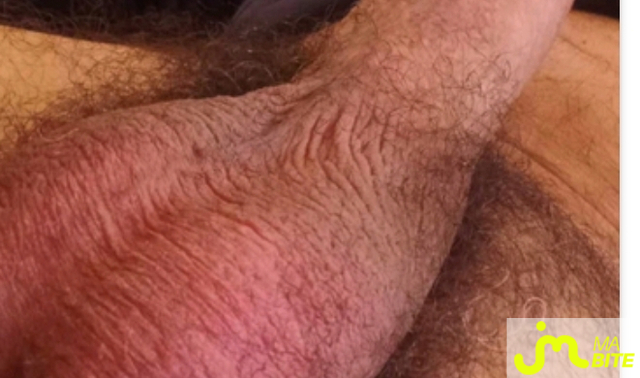 bites de Casanova1200