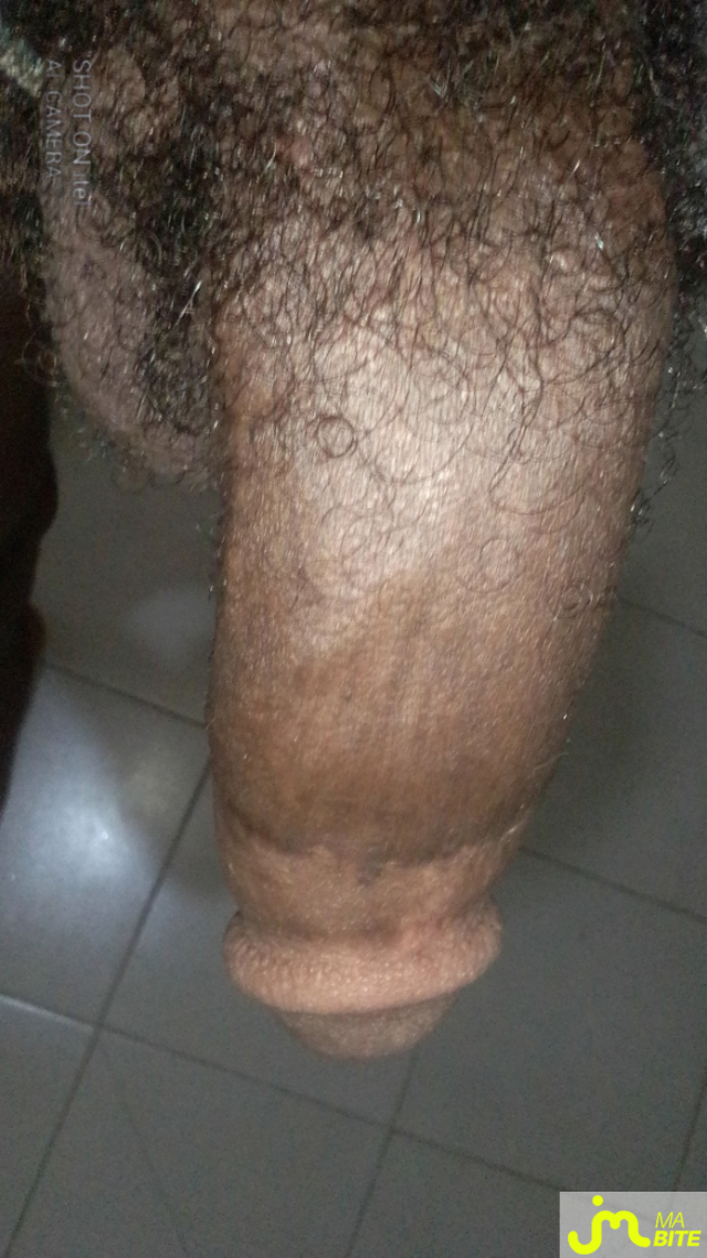 bites de Mkl245