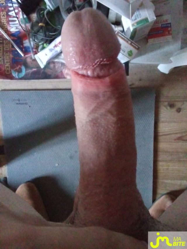 bites de Kyliannnnnnnn