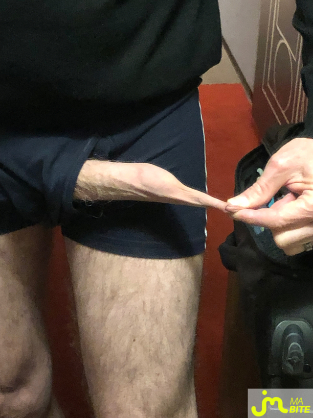 bites de longprepuce