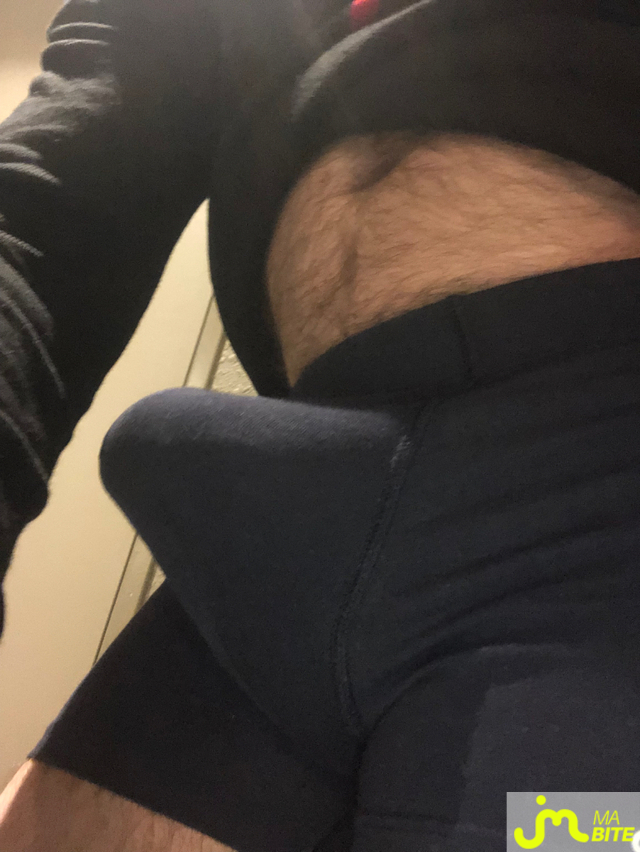 bites de longprepuce