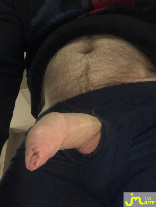 bites de longprepuce