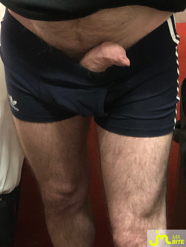 bites de longprepuce