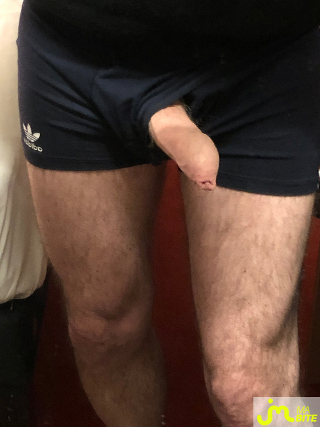 bites de longprepuce