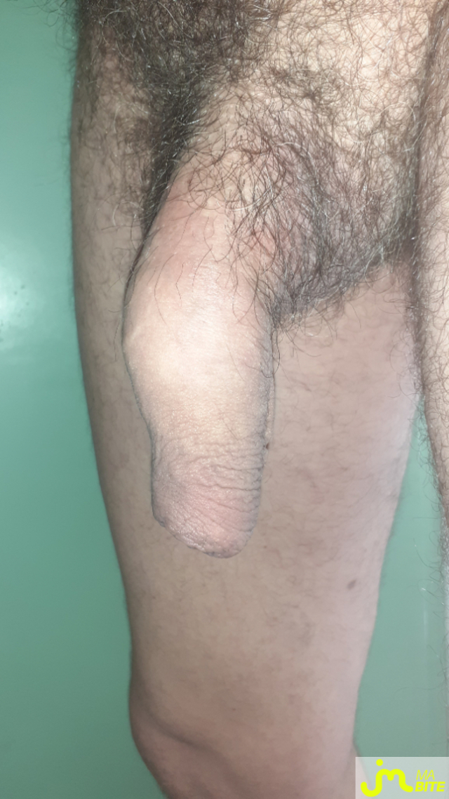 bites de Letrou