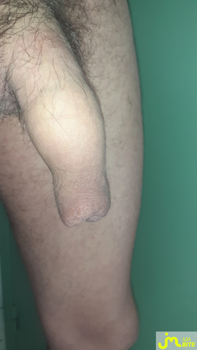 bites de Letrou
