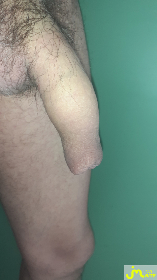bites de Letrou