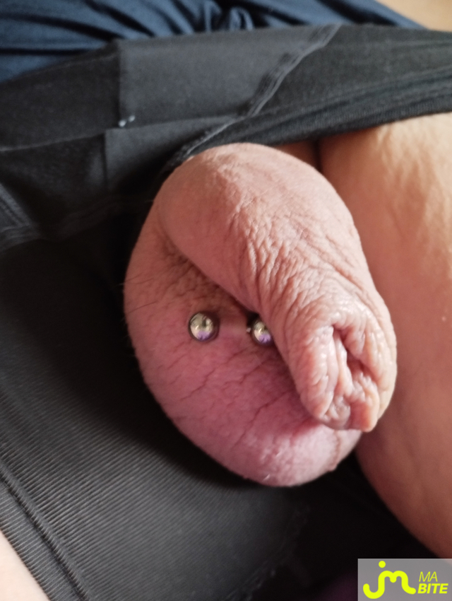 bites de monlongprepuce