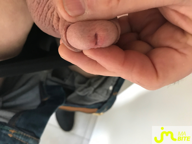 bites de Alpa56