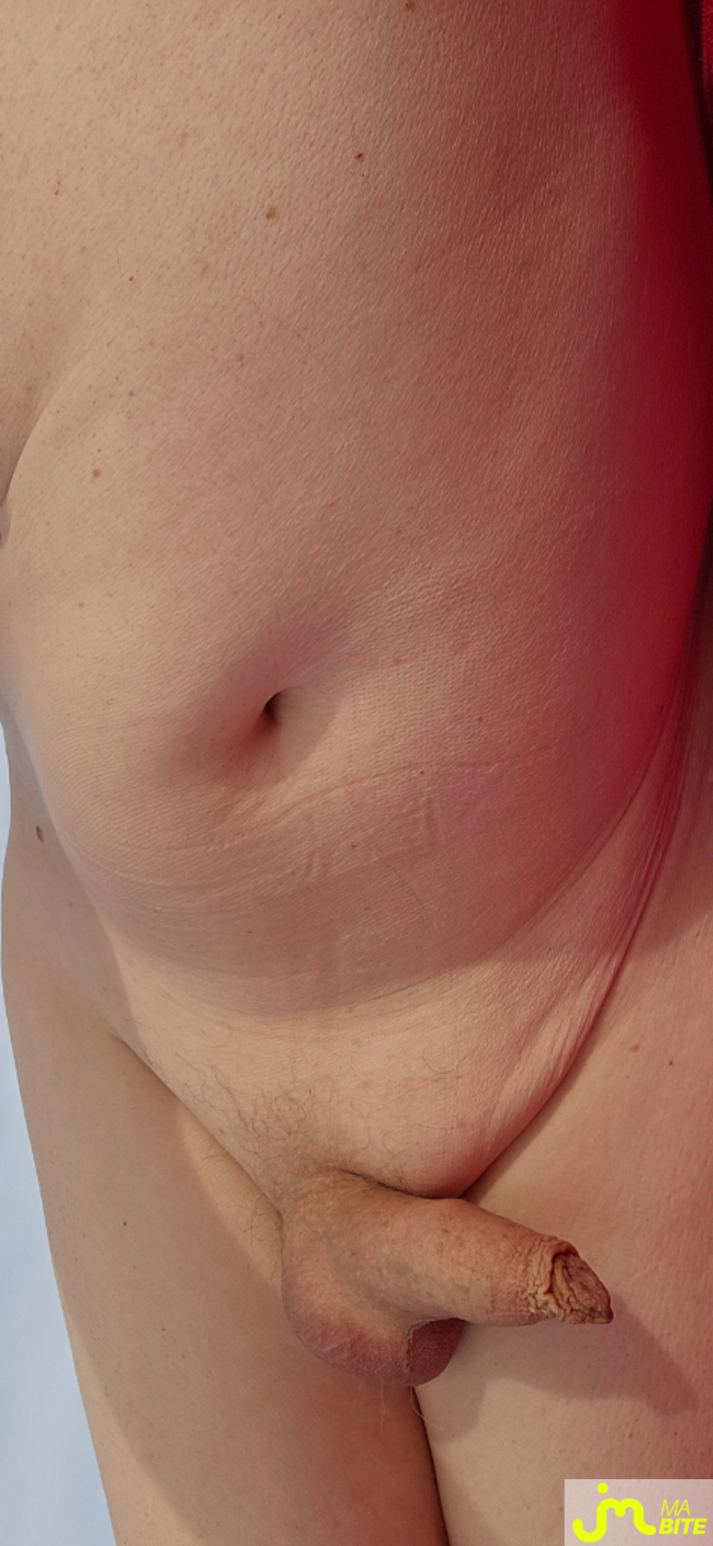 bites de naturiste83