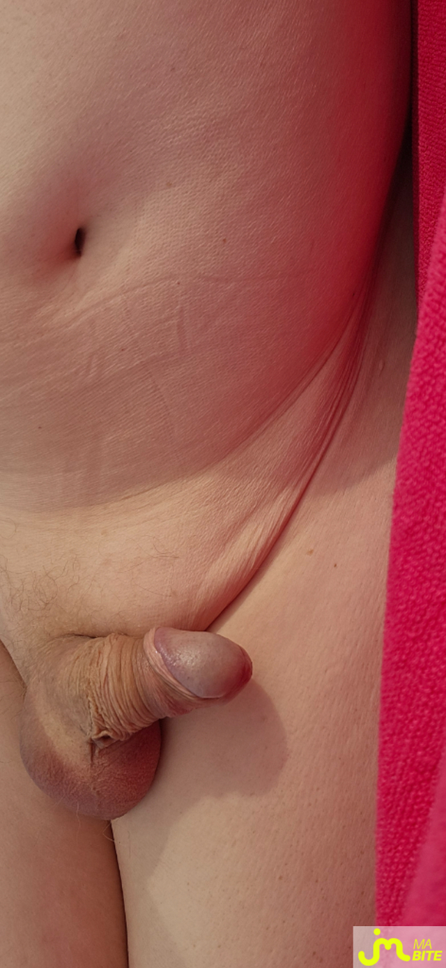 bites de naturiste83
