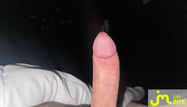 bites de Louis899