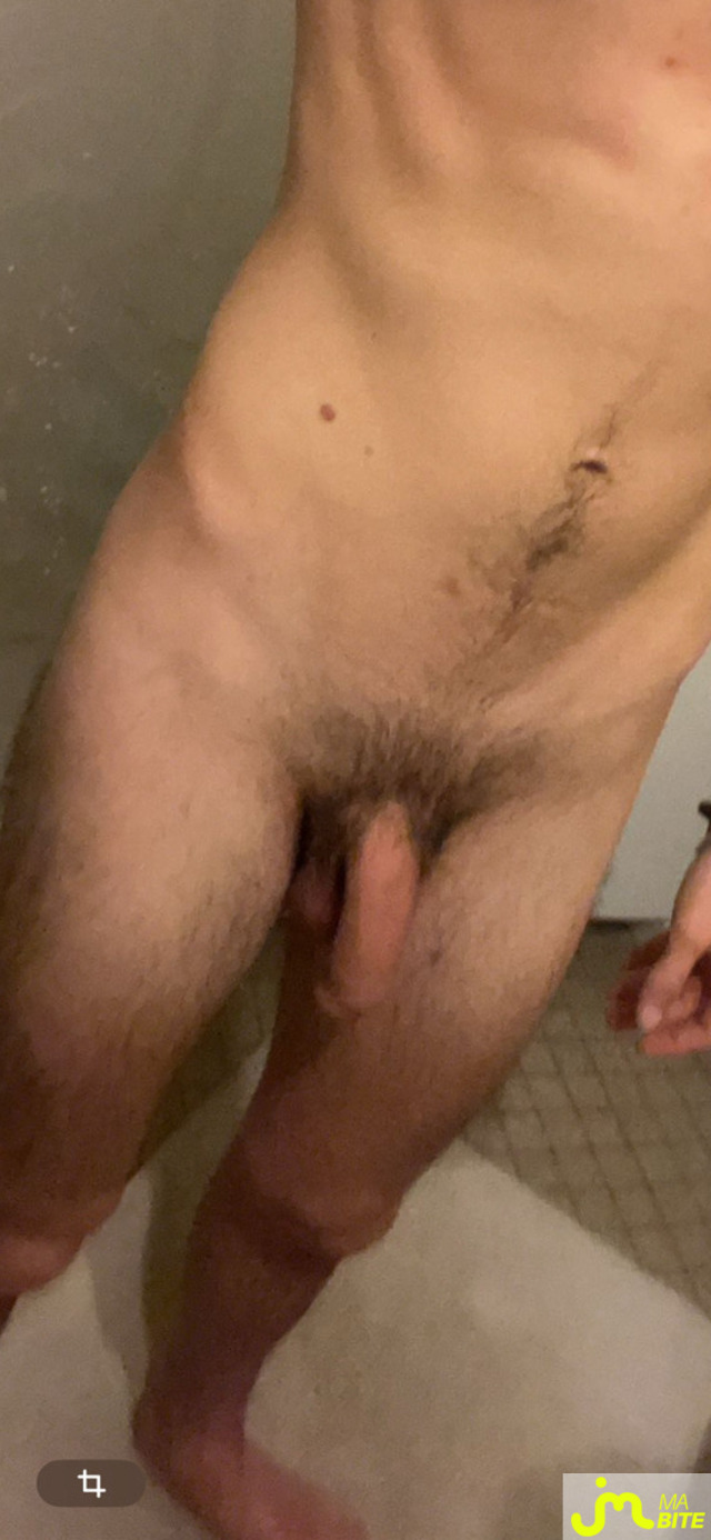 bites de surprisedu47
