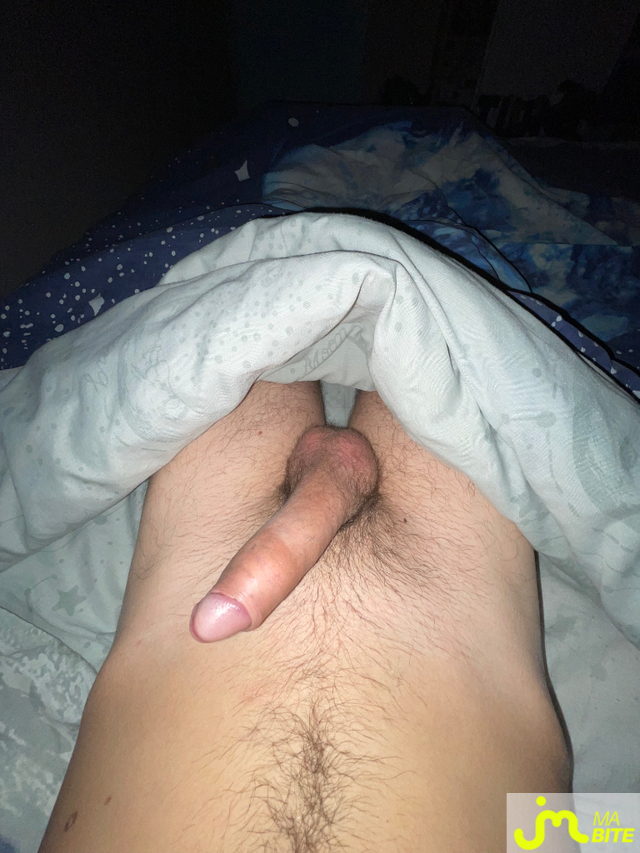 bites de surprisedu47
