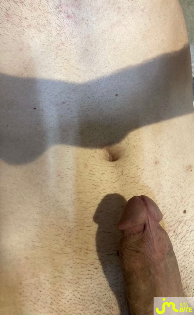 bites de Dystik